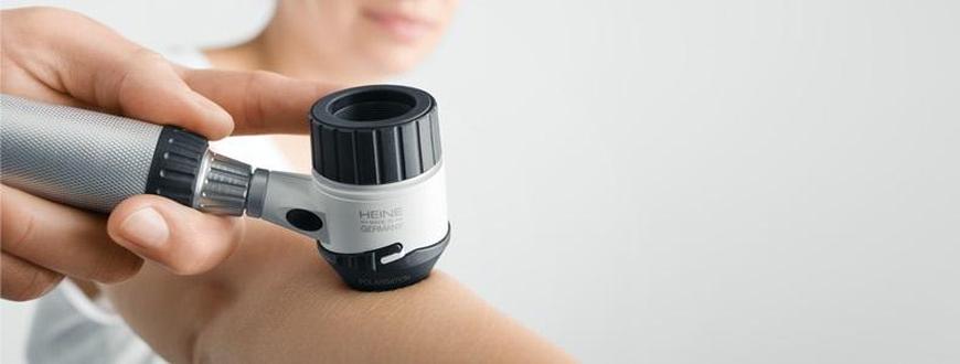 anyajegyvizsgálat anyajegyszűrés, anyajegy vizsgálat budapest